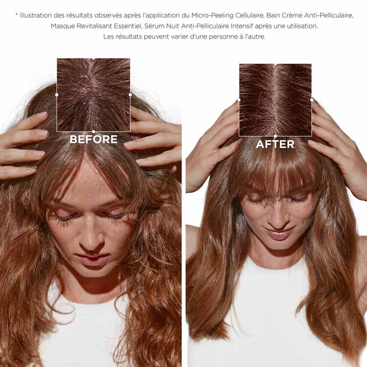 Micro-Peeling Cellulaire