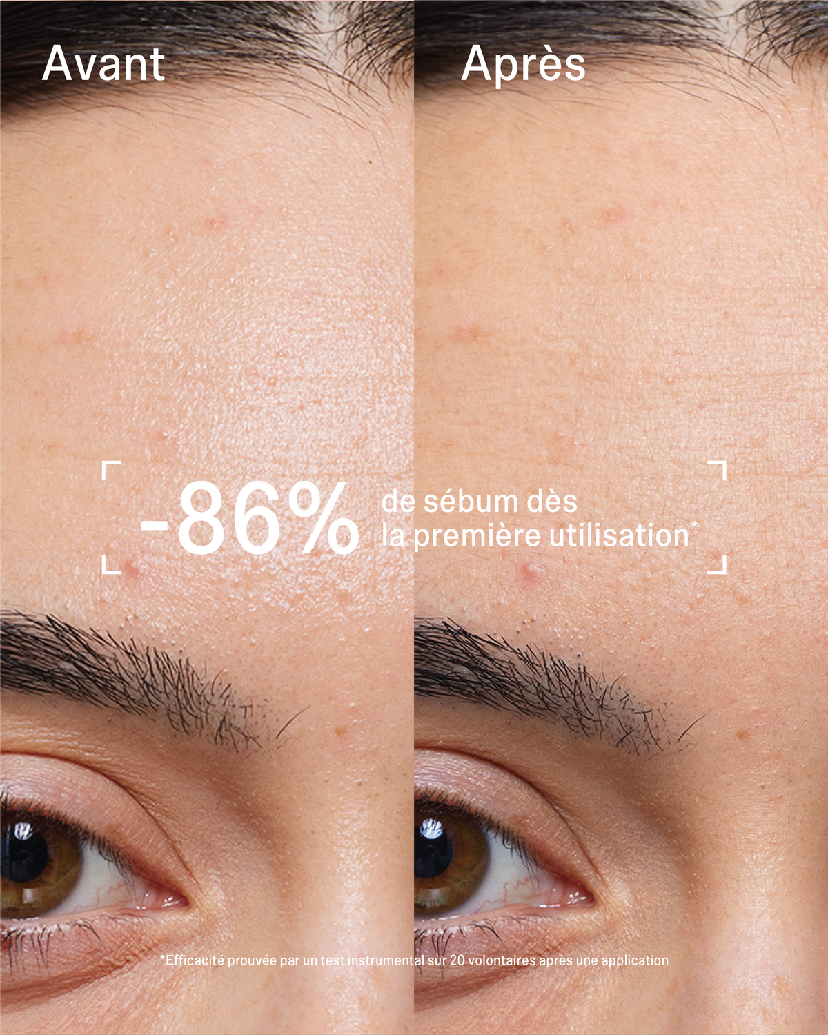Masque stick Peau Nette