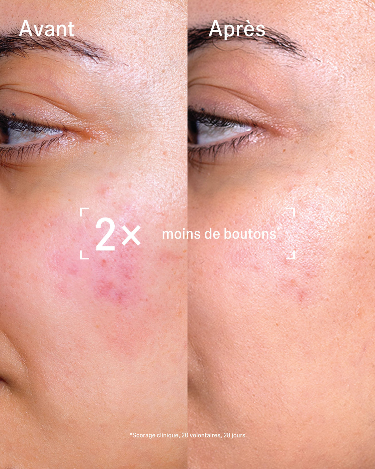 Duo SOS Imperfections