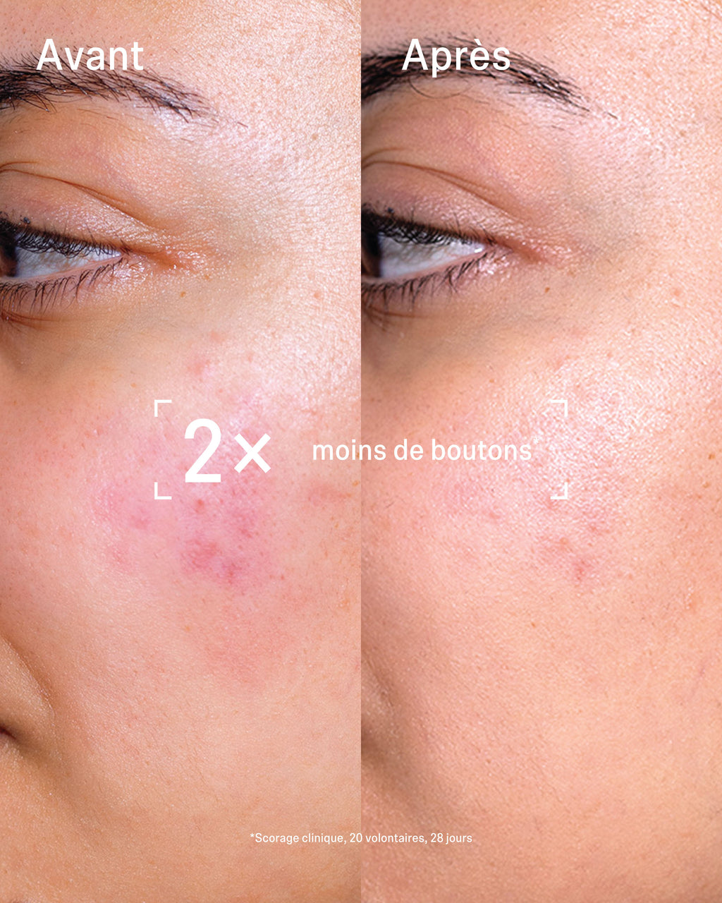 Duo Stop Boutons