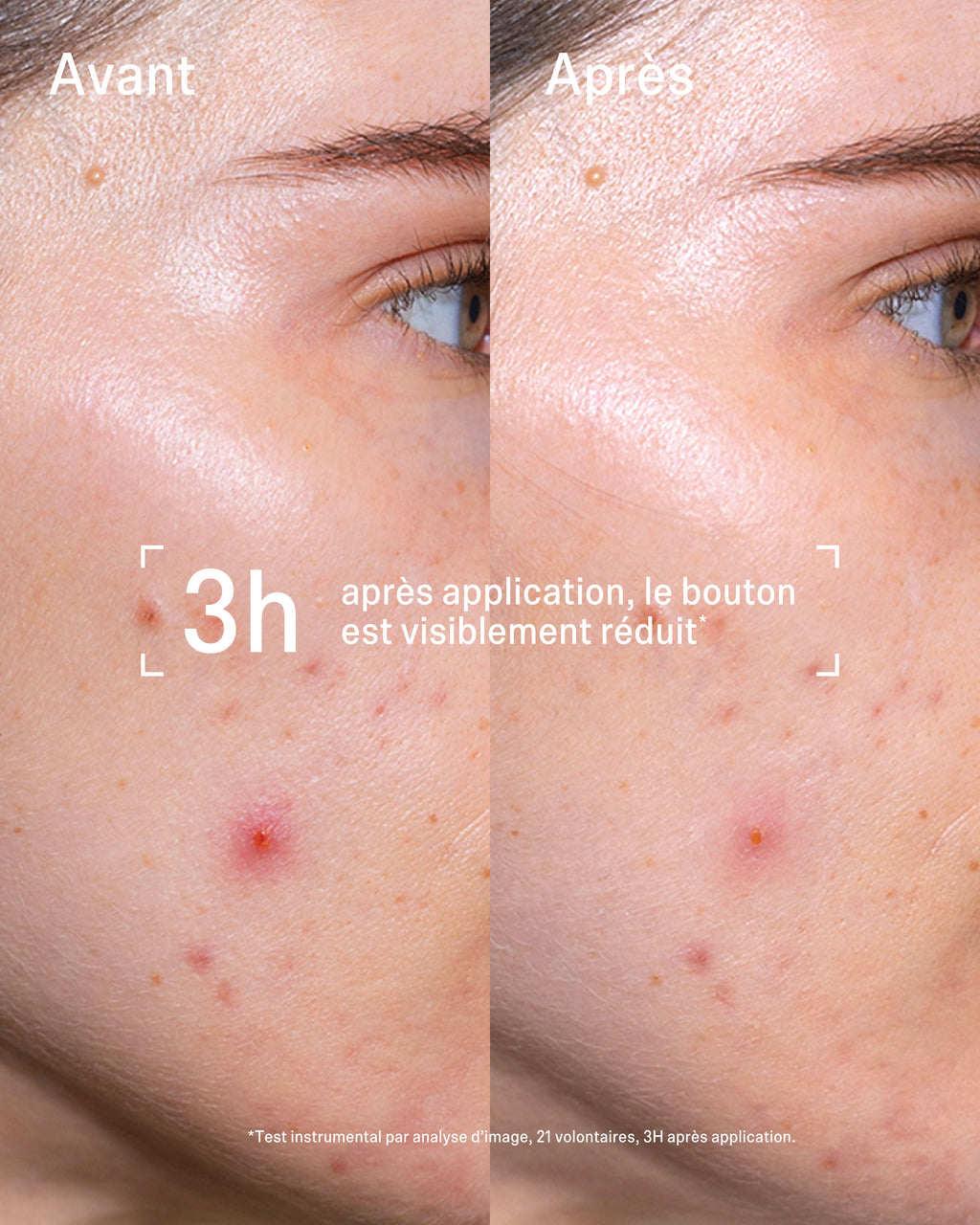 Routine Stop Boutons